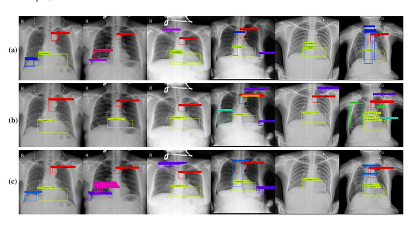 Image related to the study on venous thromboembolism.