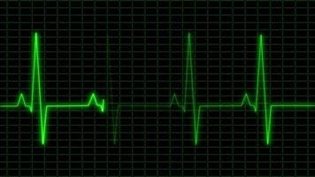 Heartbeat Analogy