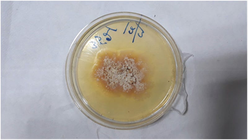 Fungal growth in a petri dish