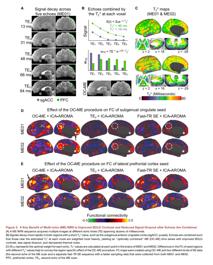 Neuroimaging Breakthroughs